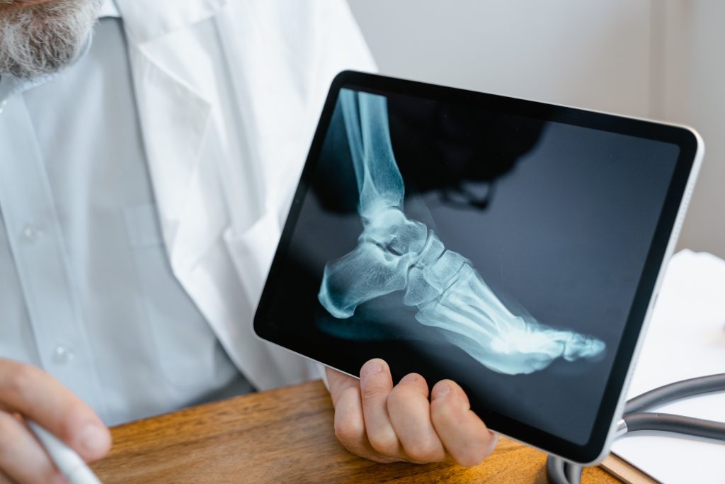 Doctor showing x-ray on a tablet